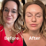 Mascarilla de biocolágeno
