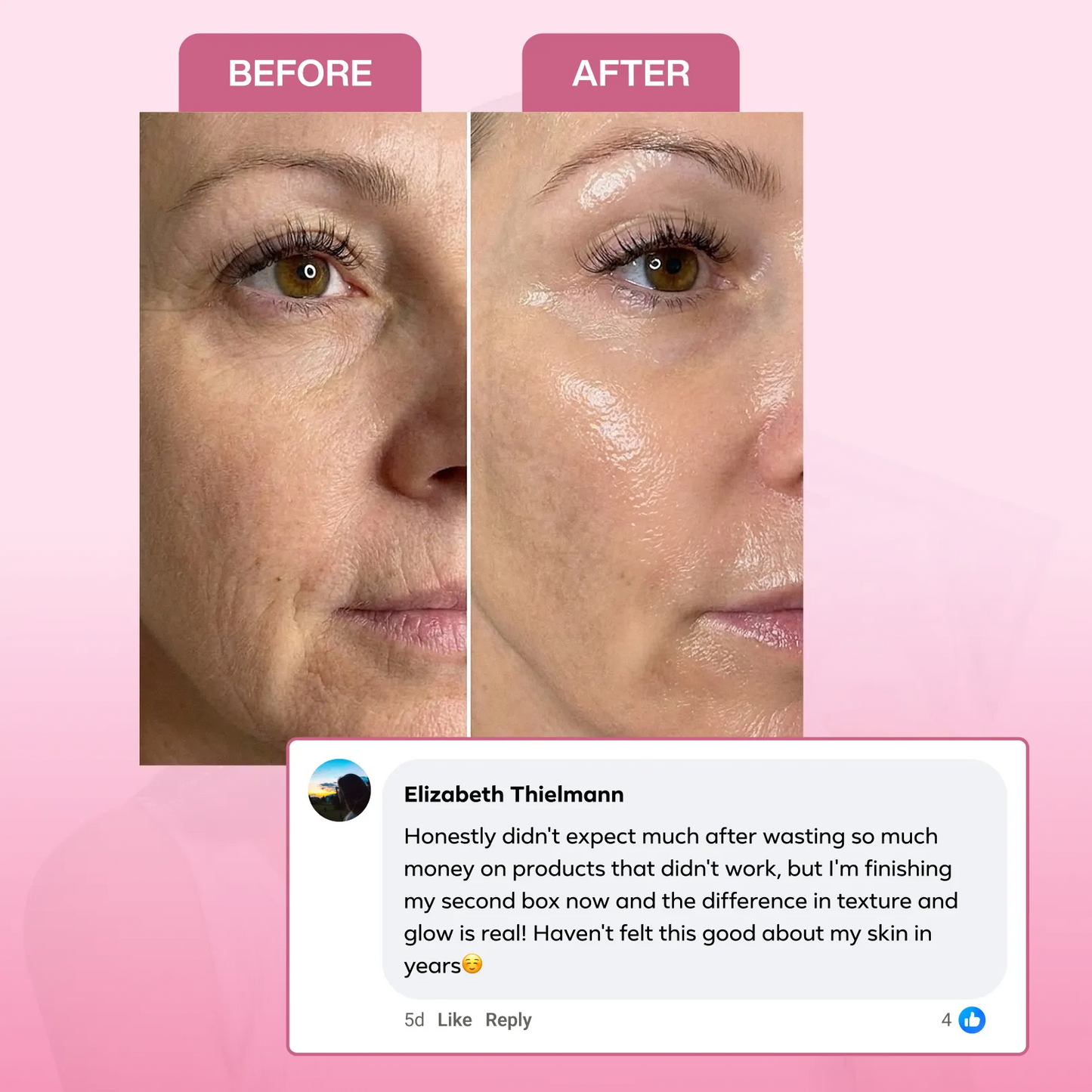 Collagen Mask Bundle