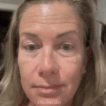 Hero GIF — mask turning white → clear on a real woman, 55+