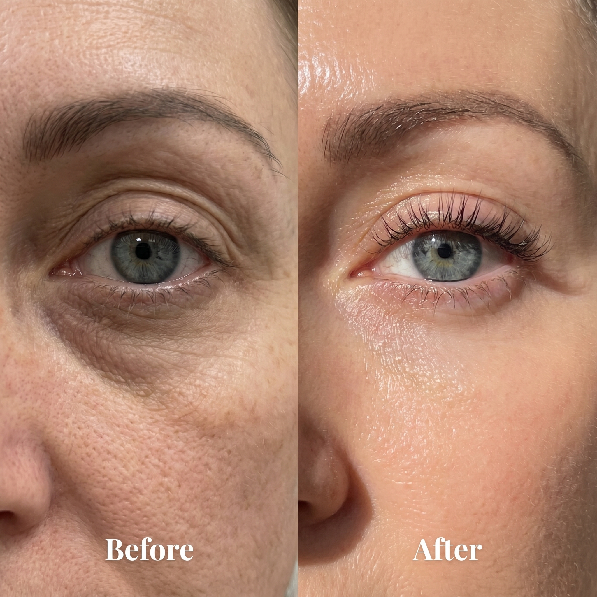 Korean Under Eye Volume Balm